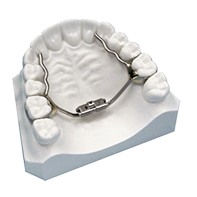 Model of smile with palatal expander