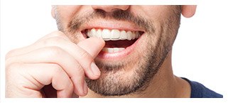 Man placing Invisalign tray