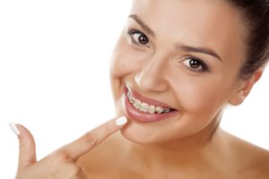 woman pointing to braces