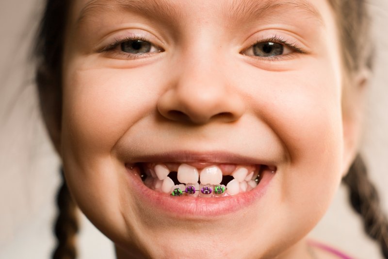 young girl smiling wearing braces