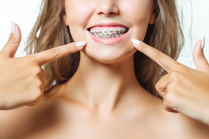 a young girl with braces and excess gum tissue points to her smile 