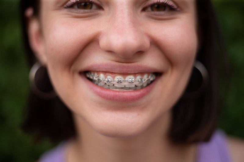 closeup of girl smiling with braces on