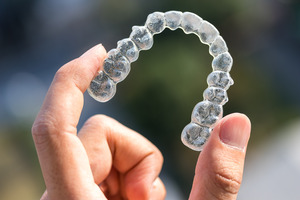 Close-up of hand holding Invisalign aligner