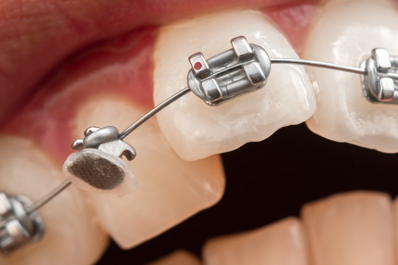 up-close view of a broken bracket